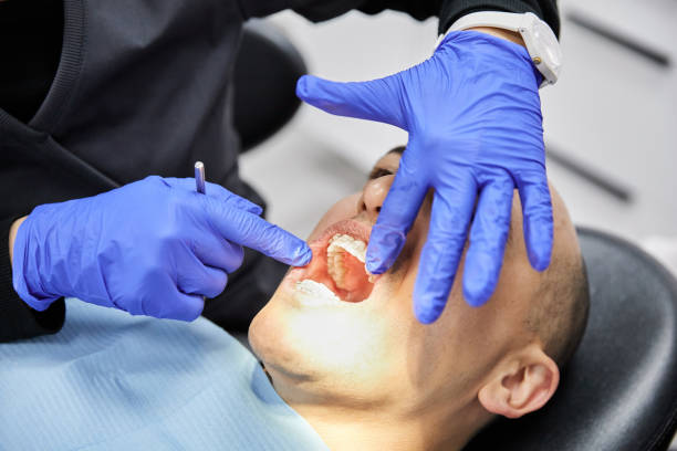 Best Emergency Treatment for Dental Infections or Abscesses in Albany, MO